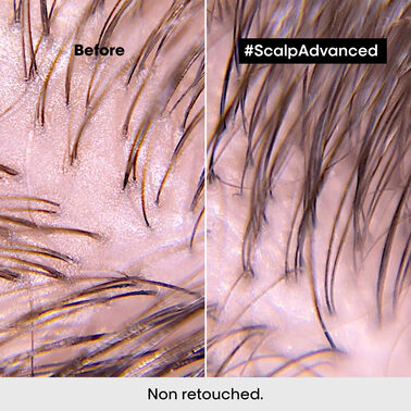 Scalp Advanced Anti-Oiliness Shampoo - L'Oréal Professionnel | L'Oréal Partner Shop